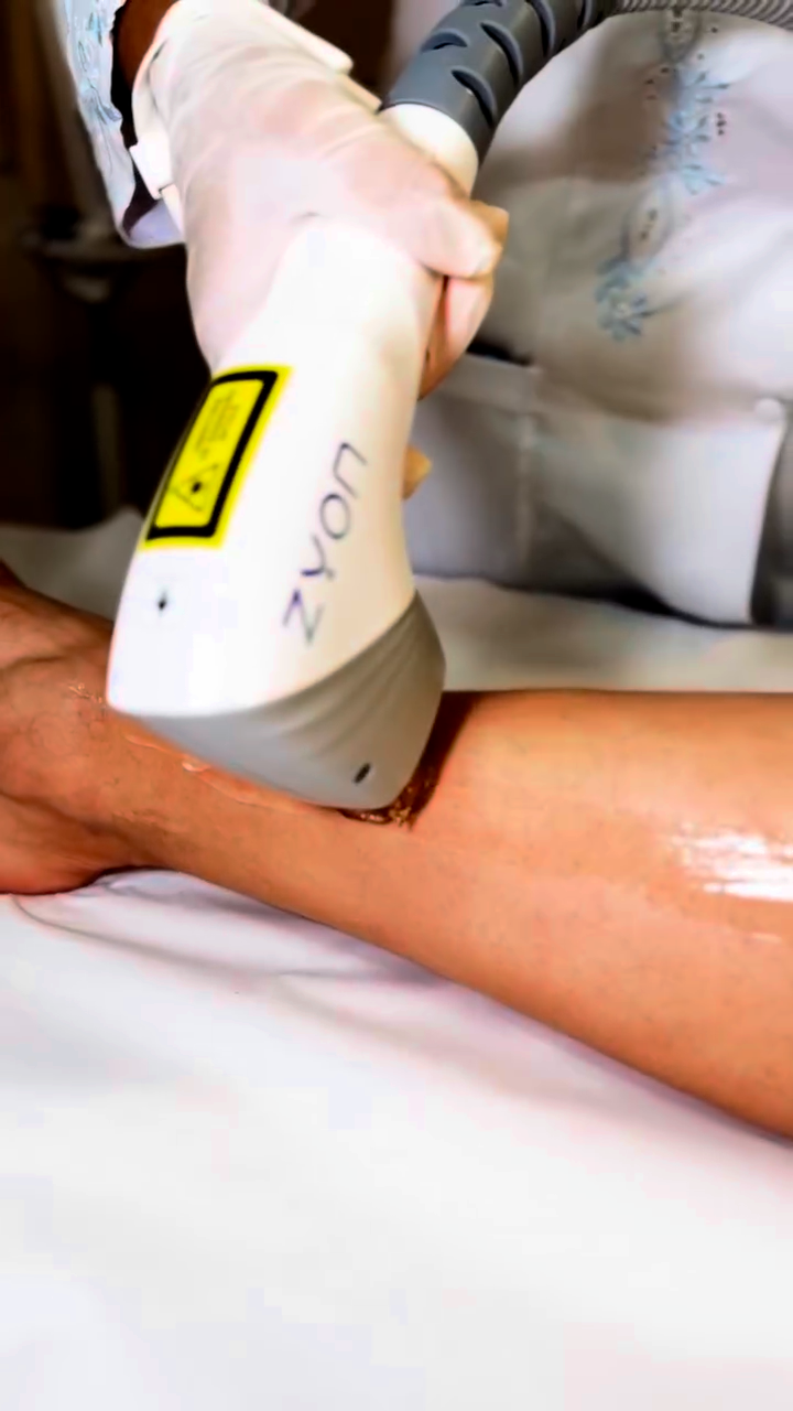 Depilação em Campinas com Conforto | Cris Gata Salão